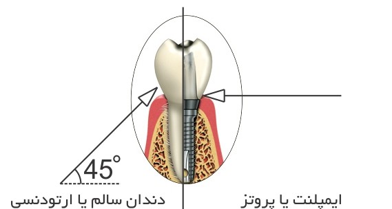 واترجت آکواجت دهانشو برای بهداشت ایملنت دندانی