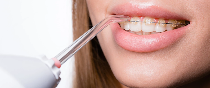 واترجت آکواجت دندان ایمپلنت